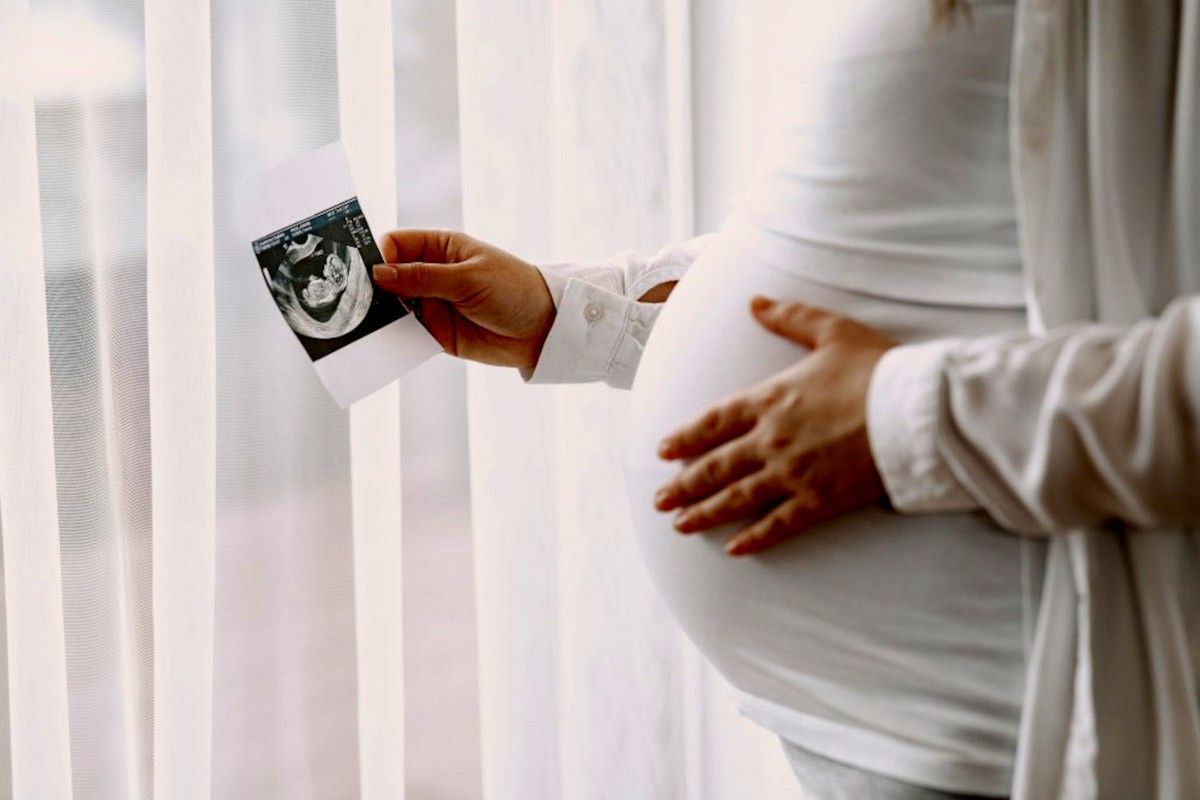 Una dona embarassada sostè una ecografia 